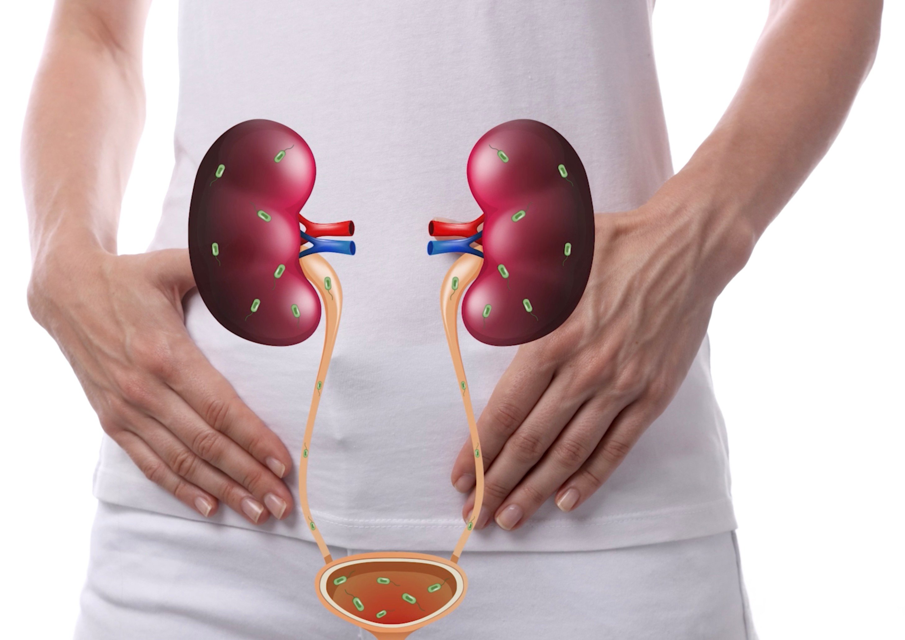 5 Best Kidney Detox Foods